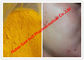 Poudres stéroïdes crues de couleur jaune/Isotretinoin pour des cancers de la peau, CAS 4759-48-2 fournisseur