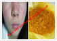Poudres stéroïdes crues de couleur jaune/Isotretinoin pour des cancers de la peau, CAS 4759-48-2 fournisseur